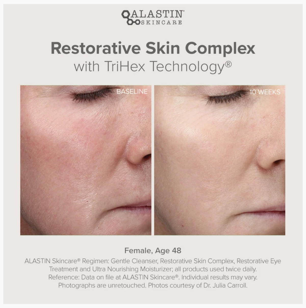 Alastin Skincare – Restorative Skin Complex Sérum Correcteur Visage 29ml